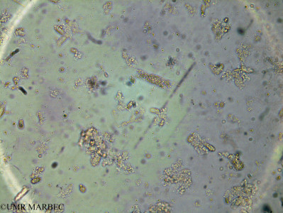 phyto/Brazilian_Amazon_coast/Amazomix_station_4/AMAZOMIX September 2021/Hemiaulus membranaceus (Am_St4_R1_INT1_hemiaulus_hauckii240722_001)(copy)_thumb.jpg